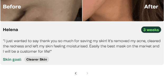 The results carousel showing one entry expanded, with before/after image toggle, customer quote, duration, and a linked result-category tag.